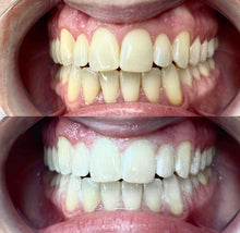 Load image into Gallery viewer, Professional Teeth Whitening Course