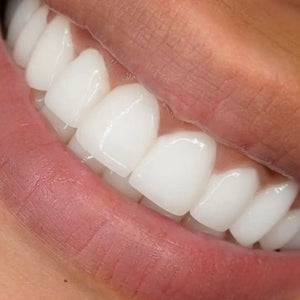 Professional Teeth Whitening Course